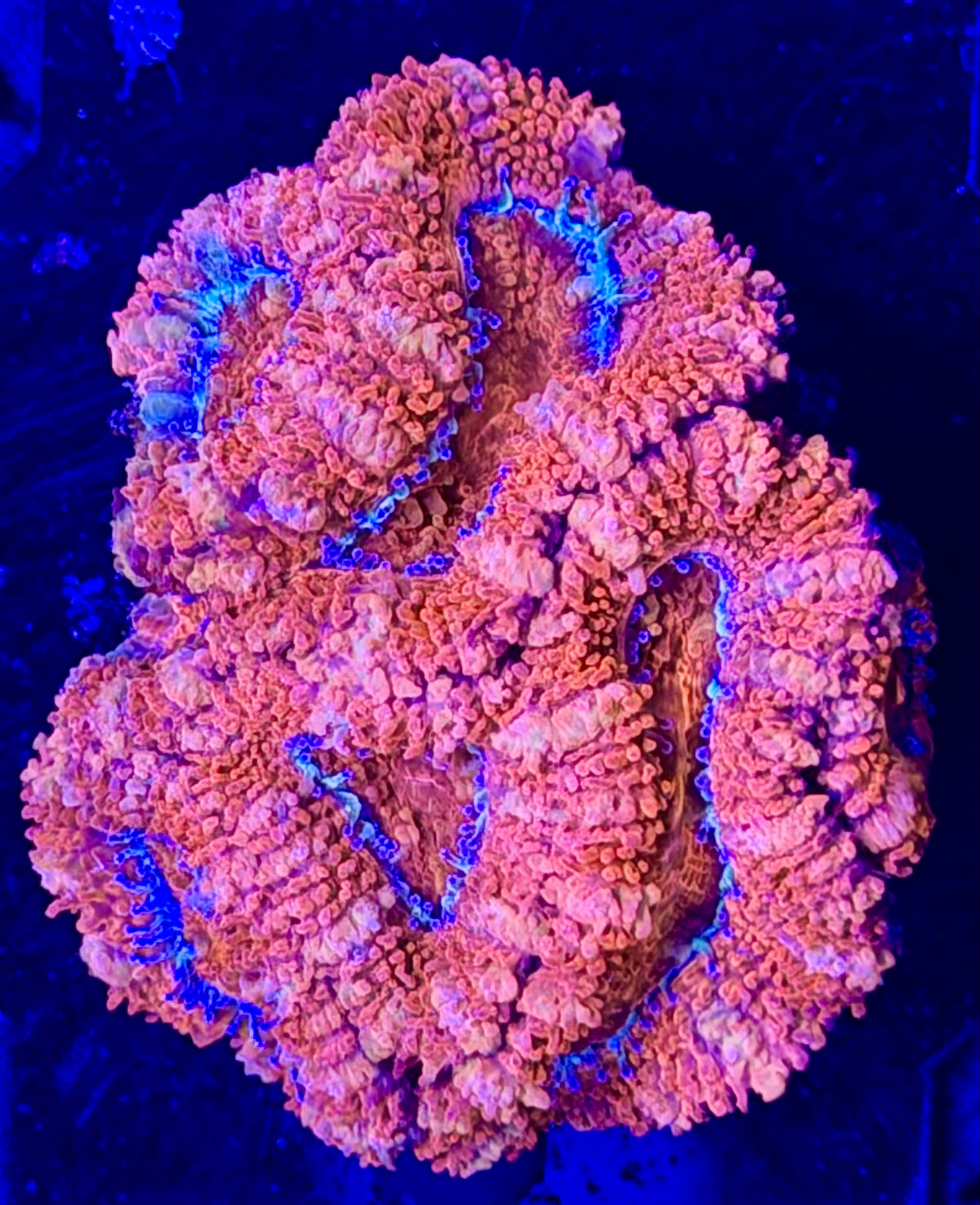 Ultra Acan